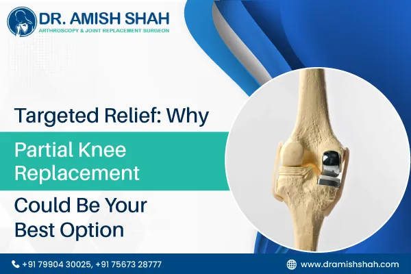 Targeted Relief: Why Partial Knee Replacement Could Be Your Best Option