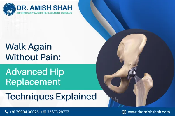 Walk Again Without Pain: Advanced Hip Replacement Techniques Explained