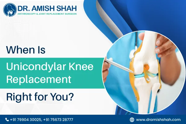 When Is Unicondylar Knee Replacement Right for You?
